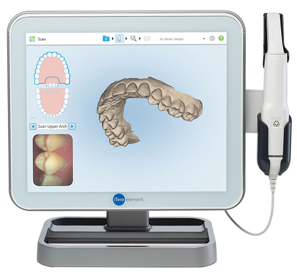 Descubre tu nueva sonrisa con el escáner Intraoral iTero – Clínica Dental  Dr. Vicente Torres